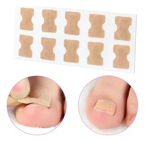 50 Parches Correctores Uñas Encarnadas